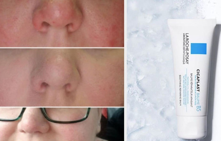 نحوه استفاده از کرم روی پوست دست یا صورت