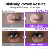 نتیجه قبل و بعد استفاده از کرم دور چشم روشنکننده و جوانساز نامبوزین