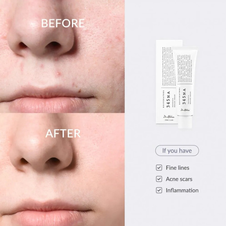 کرم ترمیم کننده دکتر التیا 345 اصل | Dr. Althea 345 Relief Cream حجم ۵۰ میلیلیتر با ضمانت اصالت کالا